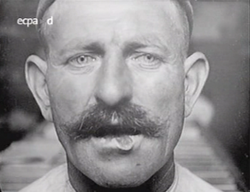 Lésions cutanées et vénériennes (F 1918)